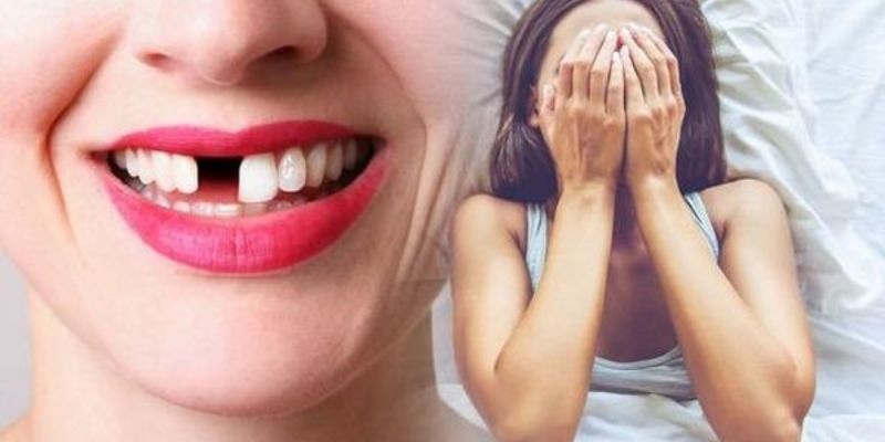 Có nhiều lý do khiến bạn mơ thấy răng rụng 